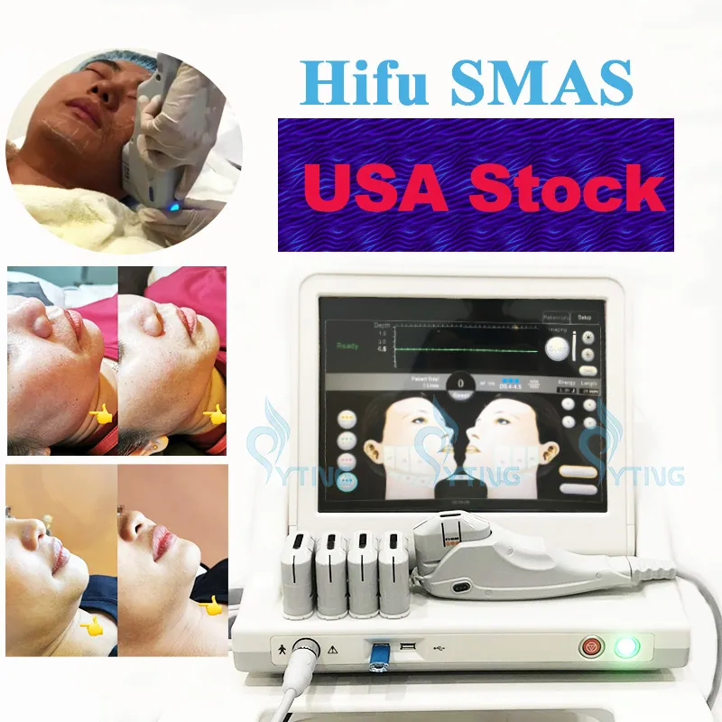 High Intensity Focused Ultrasound HIFU Beauty Equipment Face Lift Body Skin Lifting Wrinkle Removal Beauty System