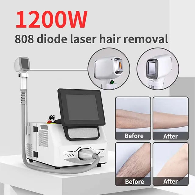 Diode 808nm laser Permanent hårborttagning Skönhetsutrustning 755NM 808NM 1064NM 3 våglängder