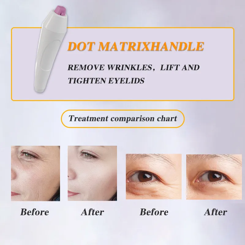 Plasma therapy machine face care resurfacing face lifting skin care plasma portable new arrival machine