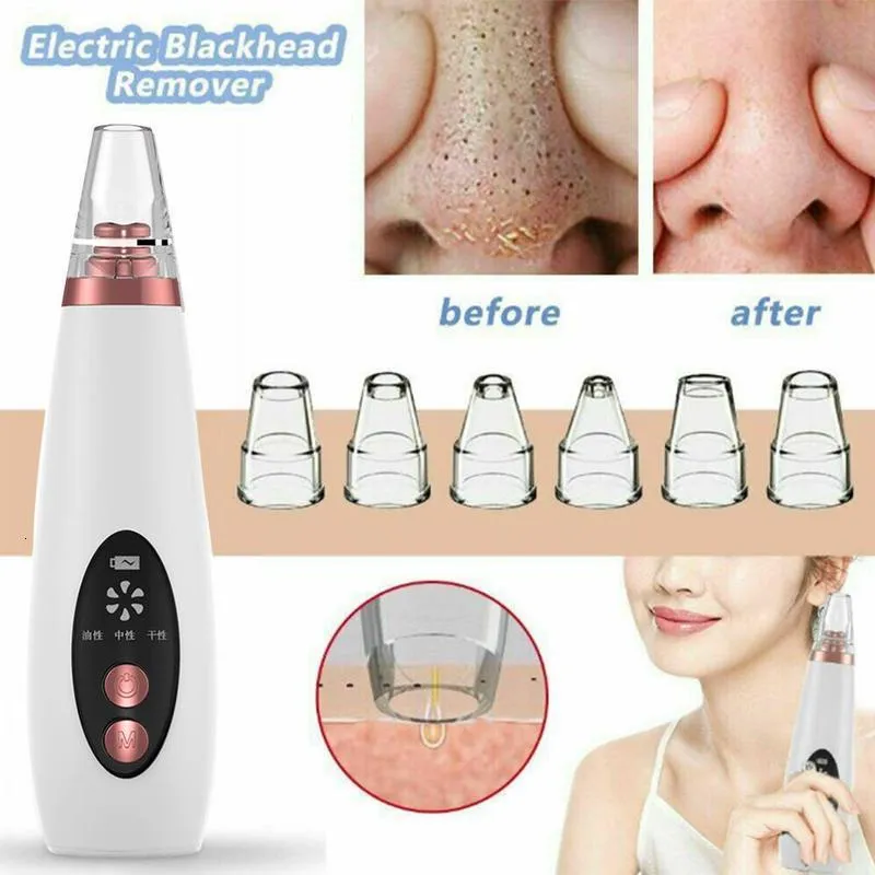 Face Massager USB Rechargeable Blackhead Remover Face Pore Vacuum Skin Care Acne Pore Cleaner Pimple Removal Vacuum Suction Tools 230411
