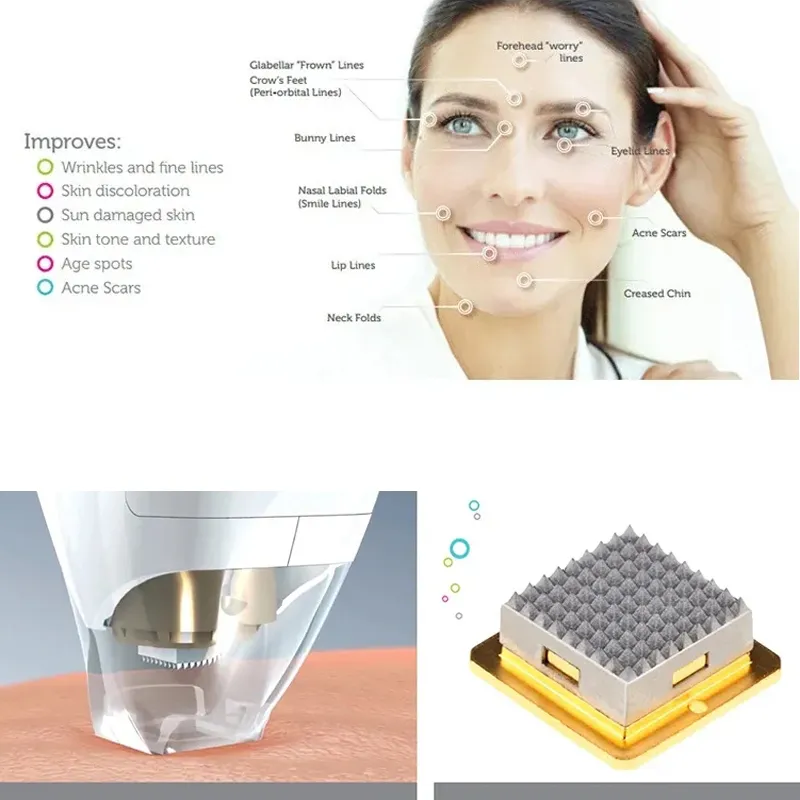 RF Microneedling Machine pour le resurfaçage de la peau des cicatrices d'acné - Pixel 8 Fractional Tixel avec une configuration à une poignée