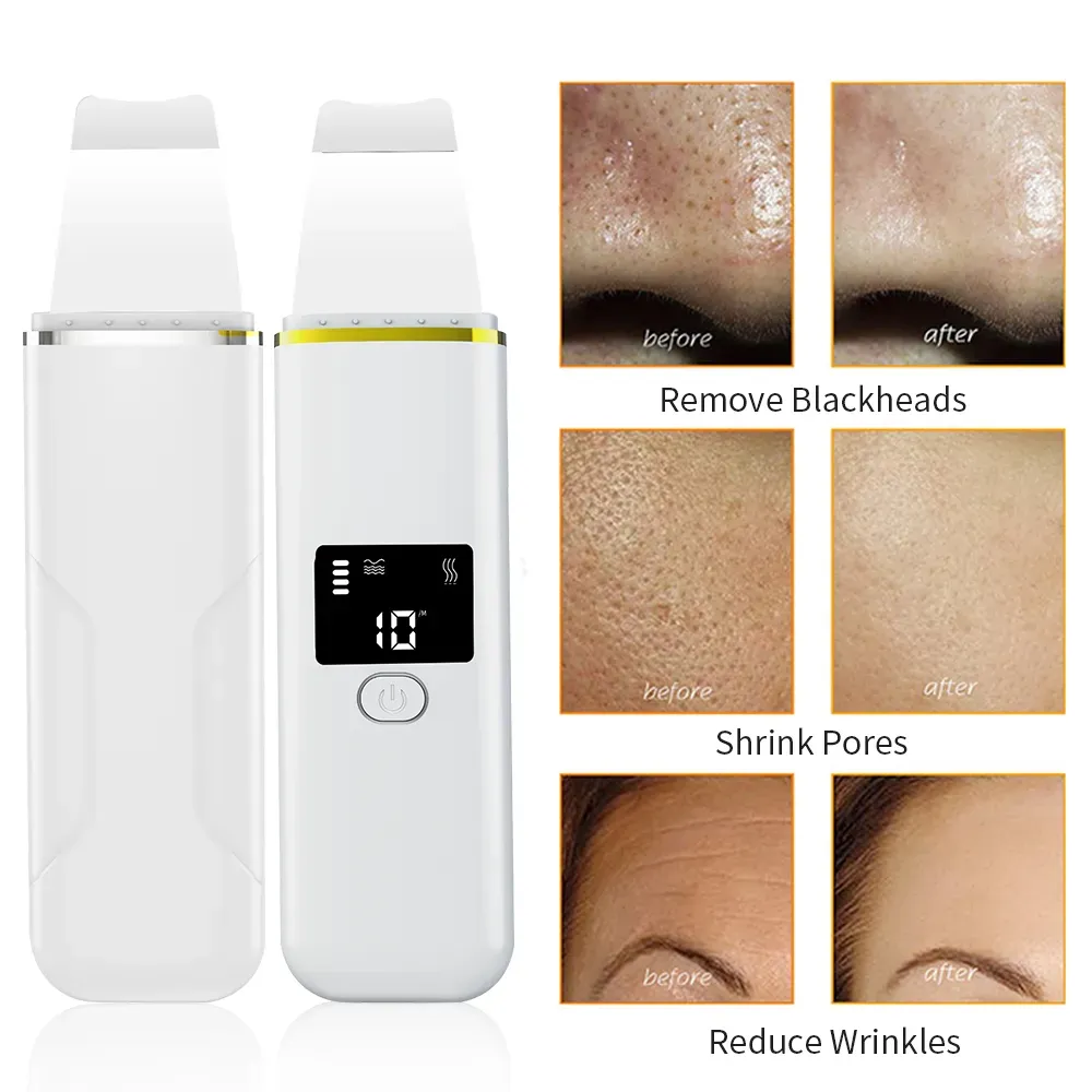 Tamax SC007 Ultrasonic Facial Skin Scrubber LCD Screen Ion EMS Therapy Face Rejuvenation Cleaner Blackhead Acne Cleaning Skin Care Tool