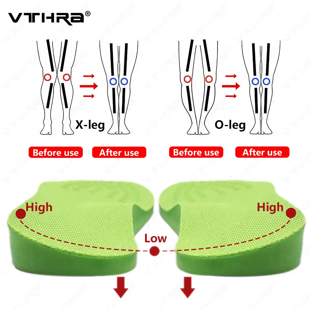 Shoe Parts Accessories O/X-Leg Orthopedic Insoles Arch Support Insole Corrigibil Bow Legs Valgus Varus Massaging Pads Beauty Leg Feet Care Insert 230217