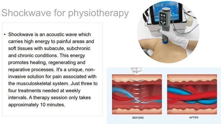 3 in 1 CET&RET Smart Tecar+EMS+Shock Wave Extracorporeal Focused ED Shockwave Therapy For Erectile Dysfunction Shockwave Machine