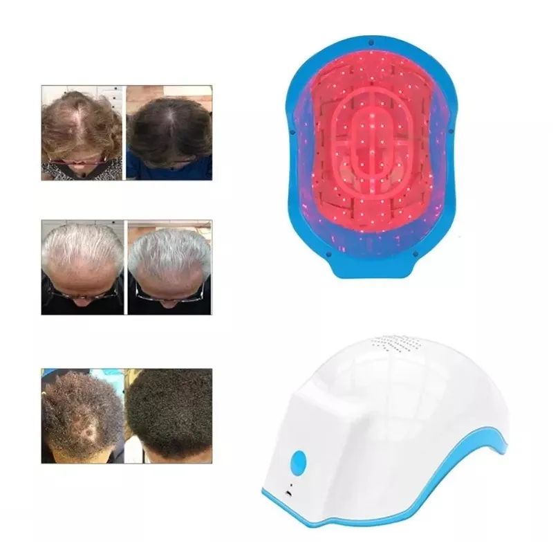 Diode Laser Hair Regrowth Treatment Growth Machine For Men And Women