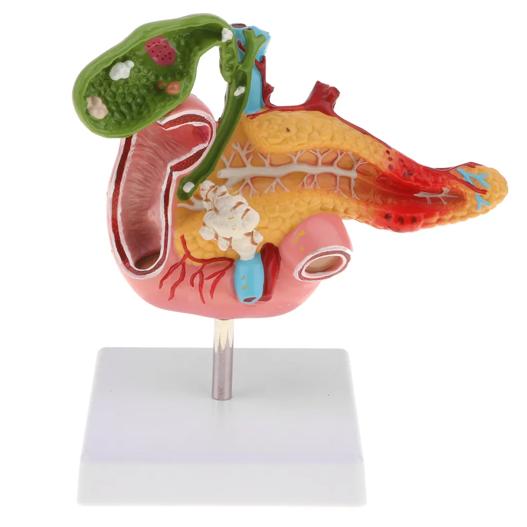 1:1 Life Size Anatomical Human Pancreas Duodenum Gallbladder Pathology Model, Lab Office Equipment Ornament for Students