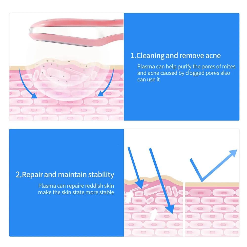 Acne Explosion Plasma Skin Rejuvenation Device - Anti Acne, Scar Removal, Facial ...