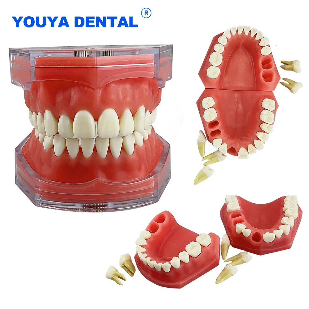 Autre modèle dentaire d'hygiène bucco-dentaire Modèle de dents amovibles Implant détachable Modèle de dent de gomme molle Dentiste Enseignement Recherche Dentisterie TYPODONT Modèle 230617