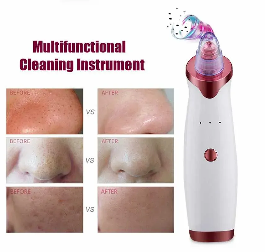 Blackhead Remover Face Skin Vacuum Pore Cleaner 5 Suction Acne Pimple Removal Tool Mini Facial Steamer drop ship epack