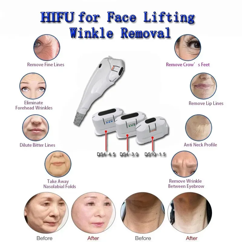 Vertical Hifu liposonix best price hifu face lifting machine liposonix slimming fast weight loss body shaping SPA