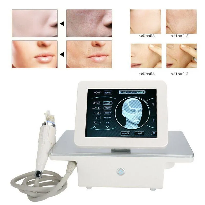 Microneedle Fractional RF Machine Micro Needle Skin Care Beauty Device Wrinkle Removal Face Lifting Tighten Shrink Pores Anti Stretch M Spba