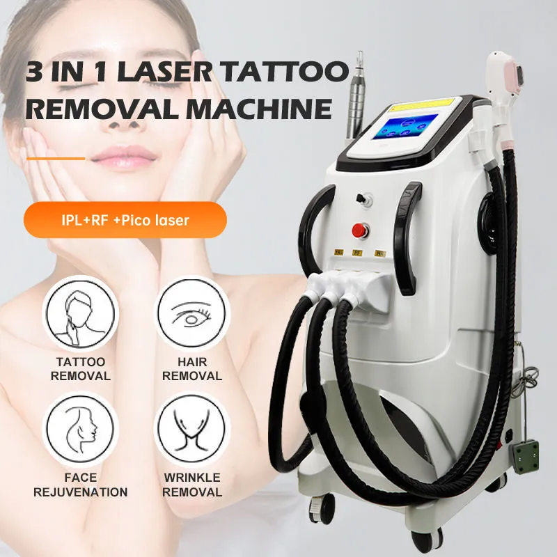 Q interruptor ND YAG Laser Remo￧￣o de p￪los Remo￧￣o de tatuagem IPL Opt Pigment Lazer System