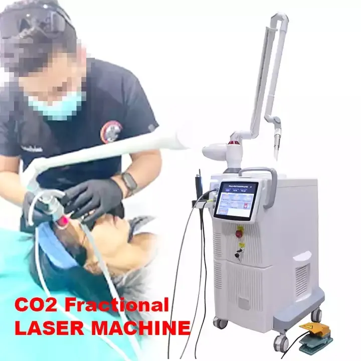 ND YAG LASER OCH CO2 LASER 4D FOTONA ERBIUM FRACTIONAL LASER STREKT MARKS Removal Skin Care Beauty Equipment 2940nm 1064nm