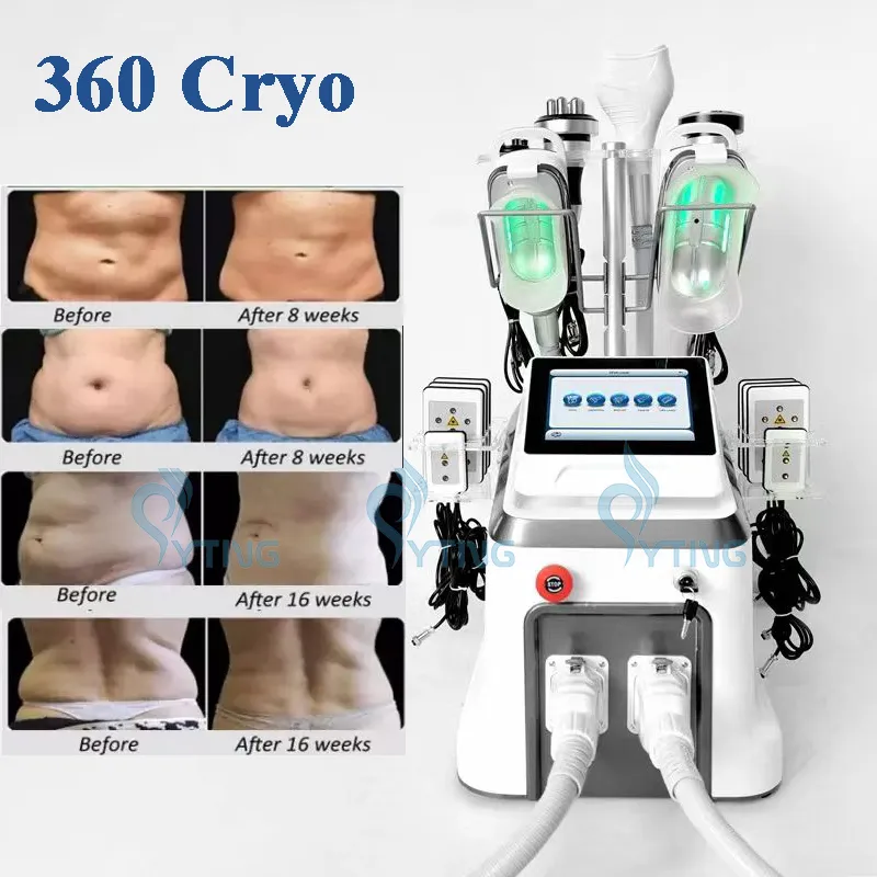 إزالة الذقن المزدوجة cryolipolyse 360 ​​تحلل البراغيل من آلة التخسيس criolipolisis بارد تجميد الدهون النحت الدهون الدهون المحترقة RF رفع الجلد