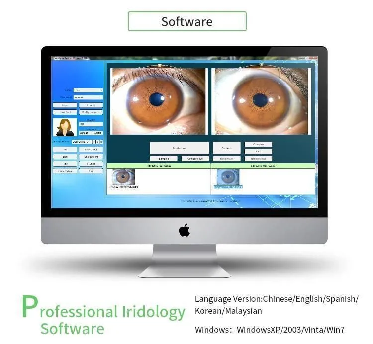 2020 High definition eye analysis iridology iris photography software iriscope eye scanner