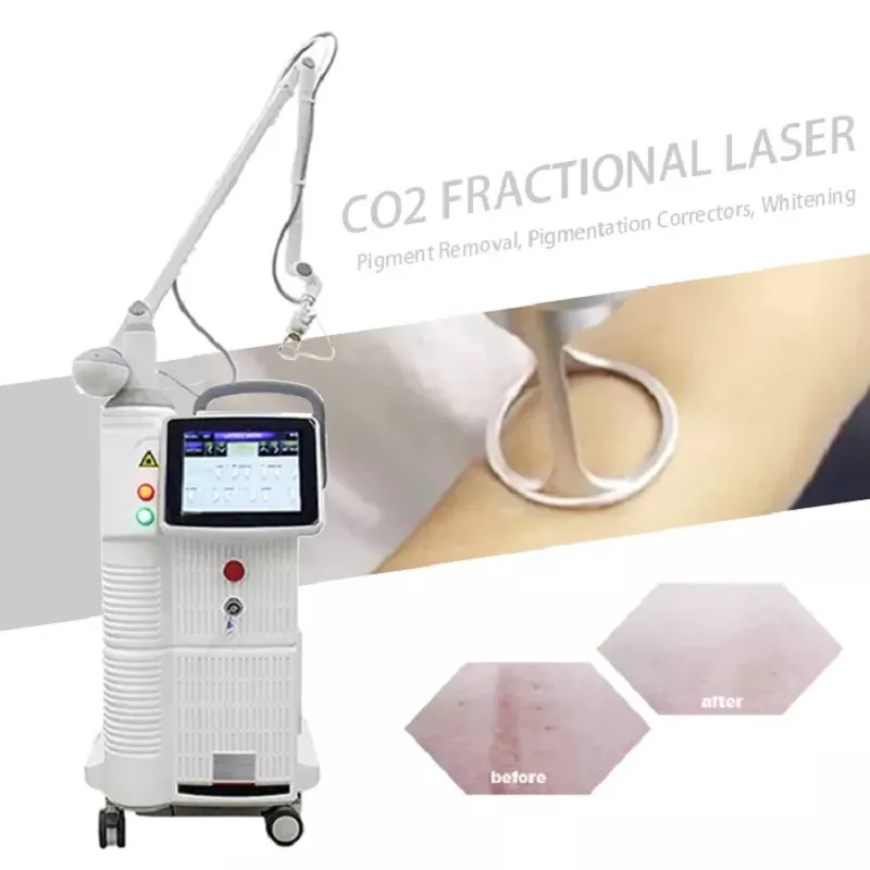 Laser médical de beauté 60W approuvé par CE pour l'élimination des vergetures de cicatrice d'acné Fractional CO2 Laser Machine de serrage vaginal Utilisation professionnelle en salon