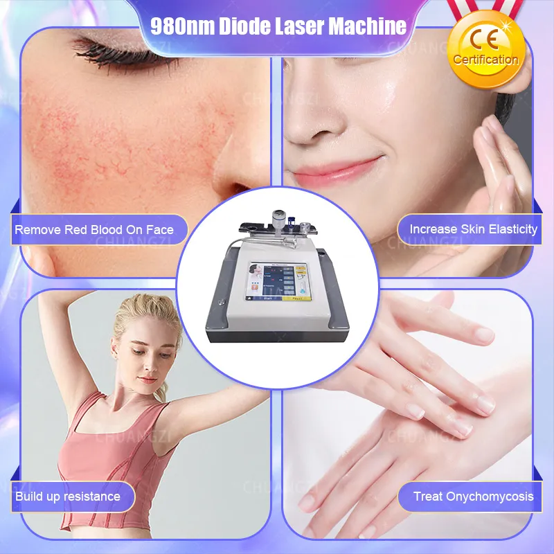 2023 BEST 30W 4 en 1 980nm Diode Laser Vessel Removal Machine To Spider Veins 980 Soins du visage Traiter l'onychomycose Aucune période de récupération postopératoire Machine