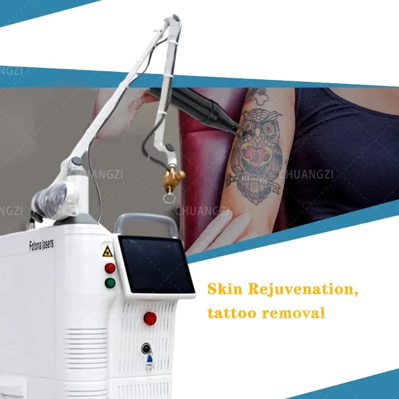 4D FOTONA SYSTEM Sistema fracionário de CO2 Laser Vaginal Sictening Scare Remova o equipamento fracionário de remoção de estiramento Diodo e YAG