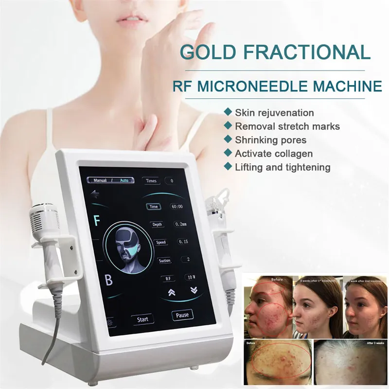 Fractional RF Microneedling Equipment Cold Hammer Acne Treatment