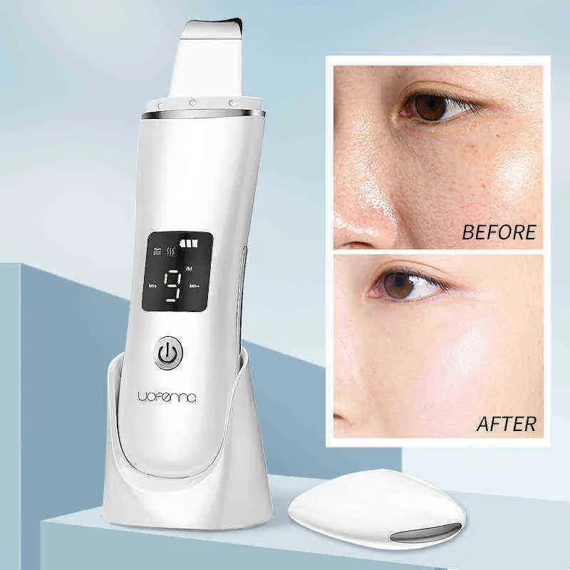 Uofenna Instrument de nettoyage du visage à ultrasons Lifting du visage Beauté Nettoyage en profondeur et élimination des taches avec base sans fil 220513