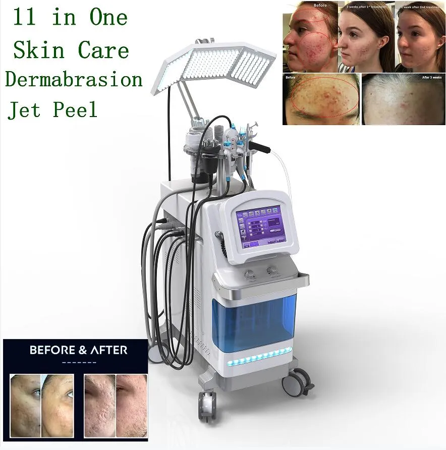 11 en 1 Jet Peel Aspirateur de dermabrasion facial multifonctionnel Machine faciale à oxygène pour points noirs Équipement BIO Nettoyage en profondeur Pigment Élimination des rides