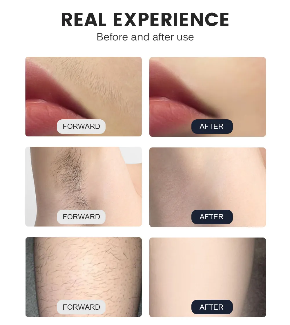 before and after use of hair removal machine