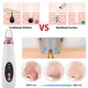 USB Rechargeable Blackhead Remover Face Pore Vacuum Skin Care Acne Cleaner Pimple Removal Suction Tools 240106