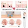 Blackhead Remover Vacuum Pore Cleaner Cleaning Black Dots Suction Exfoliating Beauty Acne Pimple Tool Skin Care 240106