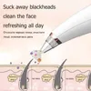 Akne Black Dot Pickel Mitesser Entferner Elektrische Vakuum Für Gesicht Reiniger Poren Gegen Schwarze Punkte Reinigende Hautpflege Werkzeug 240108