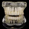 10 أسنان bling شوايات الأسنان الزركون الصافية للرجال للرجال نساء 18K الذهب مطلي بالقلق الكامل CZ Grillz مجموعة الهيب هوب Grillz