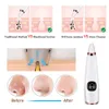 Electric Blackhead Remover Vacuum Acne Cleaner Black Spots Borttagning Deep Cleansing Por Cleaner Machine Skin Care Tools 240108