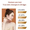 Radio frequency iron beauty device collagen cannon large pole head micro current multifunctional facial and neck wrinkle lifting and tightening Hifu Alma