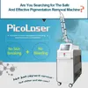 Picolaser amélioré de premier rang pour l'élimination des tatouages, blanchiment de la peau, 532nm, 755nm, 1064nm, pour le traitement des taches de naissance et des taches pigmentaires, dispositif laser Nd Yag