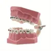 Modèle de dents orthodontiques dentaires, avec Tubes de support en métal, démonstration d'étude, 1 pièce