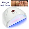 Outil fongique ongles Laser dispositif ongles champignon réparation rapide onychomycose ongle ongle enlève ongles champignon soins des pieds Cure incarnés