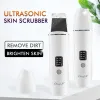 Инструмент Ckeyin Ultrasonic Skin Scrubber High -Fration Vibration Liquial Lifting Massager Face Pore Deep Clean Shovel Comedo Extractor