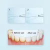 Control XIAOMI MIJIA F300 Portable Oral Irrigator Dental For Irrigator Teeth Water Flosser Bucal Calculi Oral Cleaner water thread Teeth