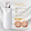 Appareils HSKOU épurateur de peau à ultrasons Machine de nettoyage du visage en profondeur pelle à éplucher nettoyeur de pores du visage Machine de levage d'épurateur de peau du visage