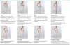 Mermaid Wedding Dresses Tulle 3D Floral Appliques Spaghetti Wedding Gowns Backless Sweep Train Vestidos De