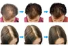 毛包検出分析を備えた頭皮ケアヘア成長マシンナノスプレー高周波振動マッサージ