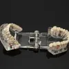 Modelo de dentes para doença de implante dentário, com ponte de restauração, dentista para ciências médicas, ensino de doenças dentárias, estudo 230x