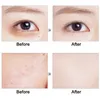 15 Color Concealer Palette Foundation Shades Contour Makeup Kit Natural Bronzer Cream Waterproof Whitening Brighten Primer TSLM1 240229