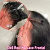 BEEOS Skinlike 13x6 HD lace Frontal Only Pre plucked Straight 6x6 5X5 HD Lace Closure Only Brazilian Human Hair 13x4 HD Frontal 240312