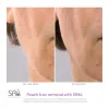 Device Spa Sciences SIMA Sonic Dermaplaning-Tool für schmerzfreies Gesichtspeeling, Pfirsichfusselentfernung, rosa Gesichtsreinigungsbürsten