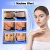 Machine HIFU haute puissance, ultrasons focalisés de haute intensité, lifting du visage, instrument de raffermissement de la peau, dispositif de rajeunissement de la peau, livraison gratuite