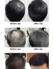 Produits en gros 10 pièces Fibers de renforcement des cheveux pour hommes et femmes, Fibers capillaires, poudre de maintien, traitement capillaire, salon de coiffure