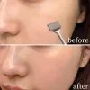 Removers 1 PCS Blackhead Remover Comedone Acne Pimple Blemish Extractor Remover Pore Cleaner Rostfritt stål Nålar Verktyg Face Skin Care