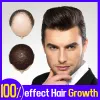 製品ヘア成長エッセンシャルオイル天然成分頭皮を刺激する髪の成長を促進する脱毛脱毛