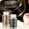 Sevich Kit de croissance des cheveux 2 pièces/ensemble capsule d'huile capillaire au gingembre biologique pour les cheveux prévenir la perte de cheveux traitement capsule de réparation des cheveux endommagés