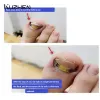 Outil outils correcteurs de l'ongle incarné récupérer le traitement de l'ongle de l'ongle pédicure professionnelle de la correction de l'ongle